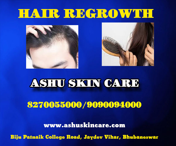 best hair regrowth treatment clinic in bhubaneswar close to kalinga hospital